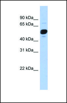 Anti-FRS3 antibody produced in rabbit