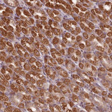 Anti-CCDC159 antibody produced in rabbit