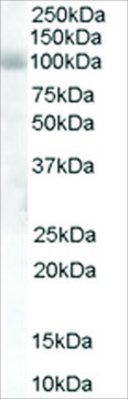 Anti-HPS6 antibody produced in goat