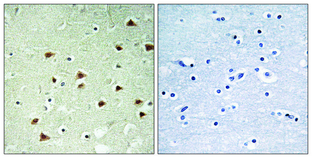Anti-ABHD14B antibody produced in rabbit