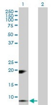 Anti-RETN antibody produced in rabbit