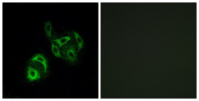 Anti-SLC27A4 antibody produced in rabbit