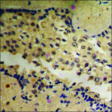 Anti-phospho-Akt (pTyr???) antibody produced in