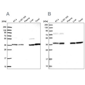 Anti-TALDO1 antibody produced in rabbit