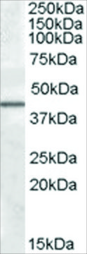Anti-CAMK1D antibody produced in goat