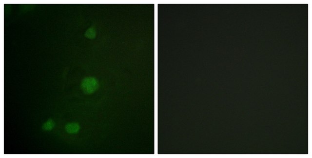 Anti-Retinoblastoma antibody produced in rabbit