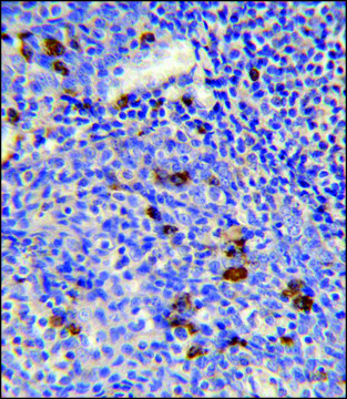 ANTI-IGLV1-40 (C-TERM) antibody produced in