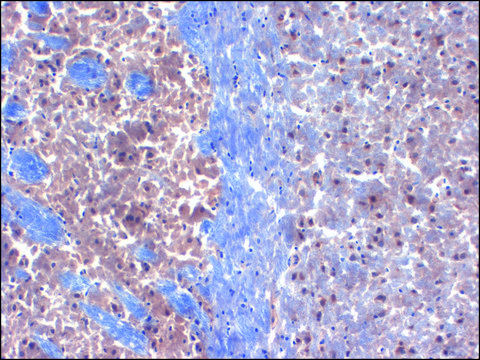 Monoclonal Anti-KCNIP3 antibody produced in