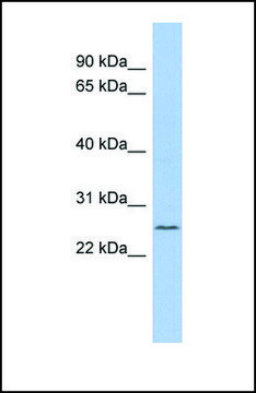 Anti-C11ORF53 antibody produced in rabbit
