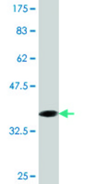 Monoclonal Anti-CRYGD, (C-terminal) antibody produced