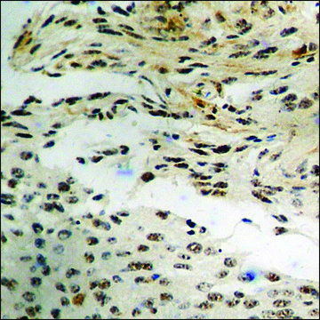 Anti-phospho-CPI17 ? (pThr³?) antibody produced