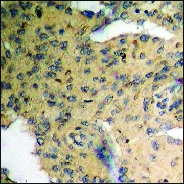 Anti-phospho-Cyclin D3 (pThr²?³) antibody produced