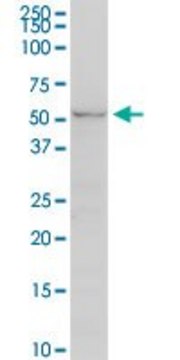 Monoclonal Anti-UGT2B7 antibody produced in
