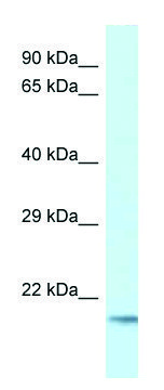 Anti-UBE2V1 (C-terminal) antibody produced in