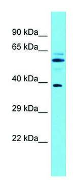 Anti-MACROD1 (N-terminal) antibody produced in
