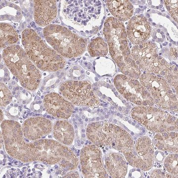 Anti-CTU1 antibody produced in rabbit