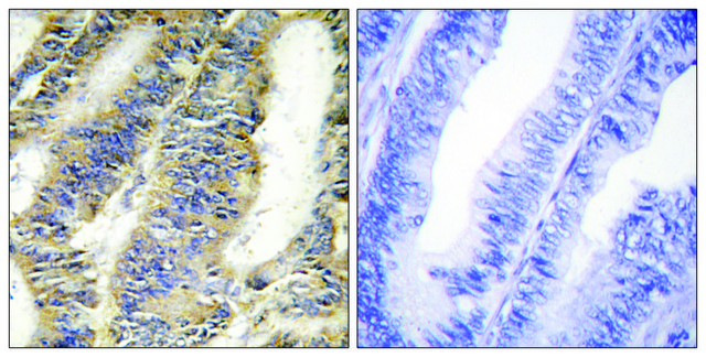 Anti-TNFA antibody produced in rabbit