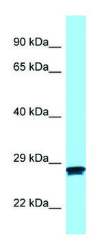 Anti-MC2R (N-terminal) antibody produced in