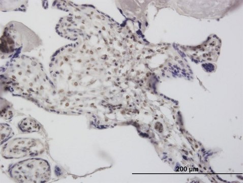Monoclonal Anti-DCPS antibody produced in