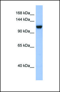 Anti-NR3C2, (N-terminal) antibody produced in