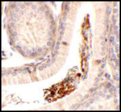 Anti-SPATA1 antibody produced in rabbit