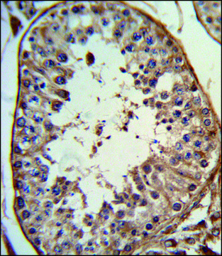 ANTI-ANGEL1 (C-TERM) antibody produced in
