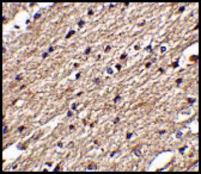 Anti-Spred3 antibody produced in rabbit