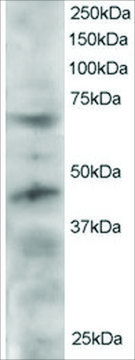 Anti-TERF1/PIN2 antibody produced in goat