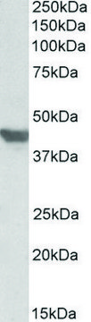 Anti-SLC2A4 (C-terminal) antibody produced in