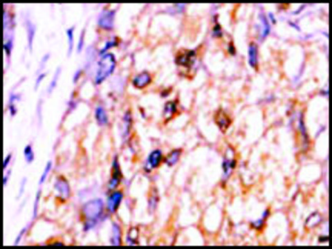 Anti-CTDSP1-V250 (C-term) antibody produced in