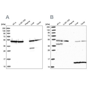 Anti-ST13 antibody produced in rabbit