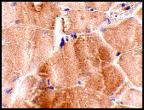 Anti-JPH2 (ab2) antibody produced in