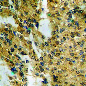 Anti-phospho-MEK2 (pThr³??) antibody produced in