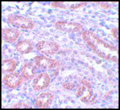 Anti-APC5 antibody produced in rabbit