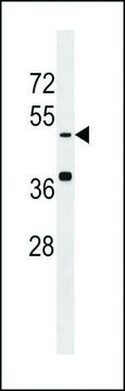 ANTI-KREMEN(N-TERMINAL) antibody produced in rabbit