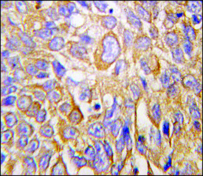 Anti-DDIT4 (N-term) antibody produced in
