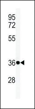 ANTI-FCGR1A (CENTER) antibody produced in