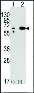 ANTI-BECLIN 1 antibody produced in