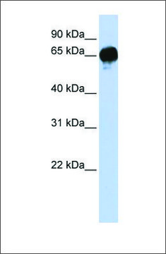 Anti-DGKE antibody produced in rabbit