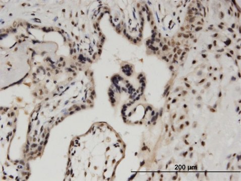 Monoclonal Anti-BCL11A antibody produced in
