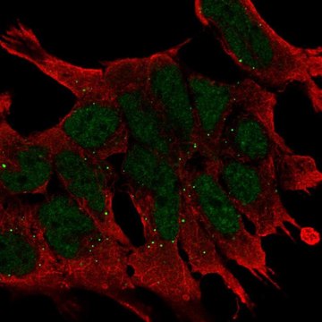 Anti-WNT2B antibody produced in rabbit