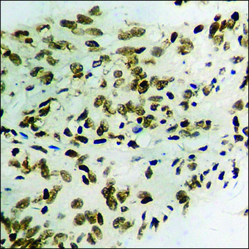 Anti-phospho-JAK2 (pTyr¹???) antibody produced in