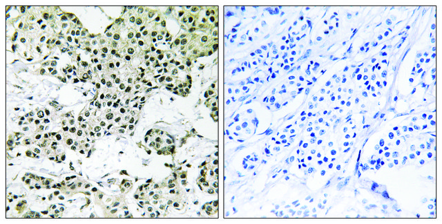 Anti-THOC5 antibody produced in rabbit