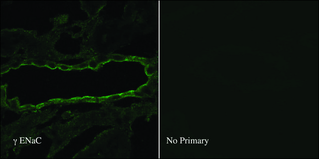 Anti-SCNN1G antibody produced in rabbit
