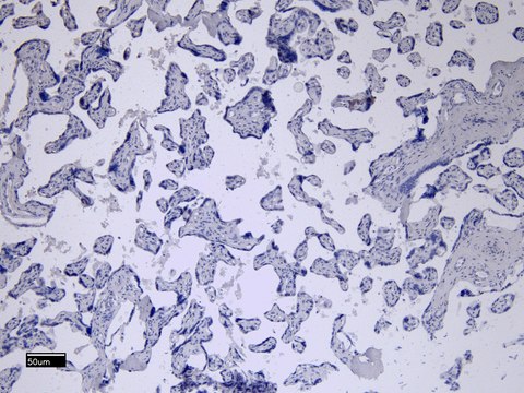 Anti-CD32/FCGR2B antibody produced in goat