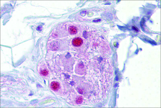 Anti-NR3C1 antibody produced in rabbit