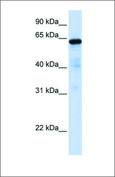 Anti-FOXN4 antibody produced in rabbit