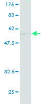 ANTI-CA1 antibody produced in mouse