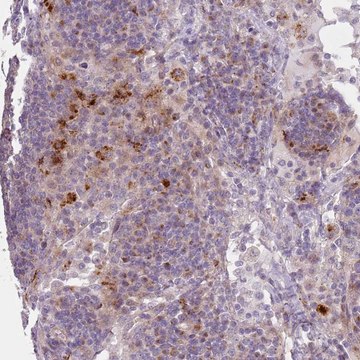 Anti-PVRIG antibody produced in rabbit