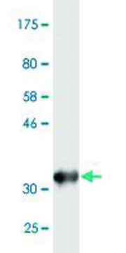 Monoclonal Anti-DHX9, (N-terminal) antibody produced